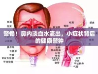 警惕！鼻內淡血水流出，小癥狀背后的健康警鐘