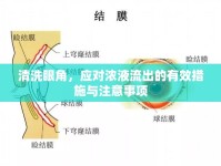清洗眼角，應(yīng)對濃液流出的有效措施與注意事項