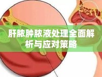 肝膿腫膿液處理全面解析與應(yīng)對(duì)策略