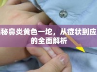 揭秘鼻炎黃色一坨，從癥狀到應(yīng)對的全面解析
