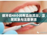 拔牙后48小時(shí)有血絲流出，正常現(xiàn)象與注意事項(xiàng)