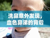 洗鼻意外發(fā)現(xiàn)，血色鼻涕的背后真相