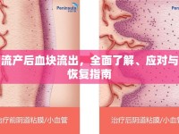 流產(chǎn)后血塊流出，全面了解、應(yīng)對與恢復(fù)指南