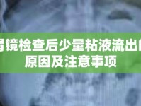 胃鏡檢查后少量粘液流出的原因及注意事項(xiàng)