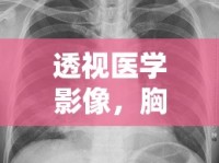 透視醫(yī)學影像，胸片曝光的奧秘與重要性