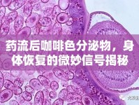 藥流后咖啡色分泌物，身體恢復的微妙信號揭秘
