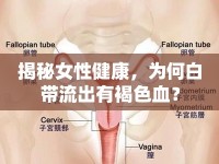 揭秘女性健康，為何白帶流出有褐色血？