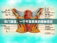 肛門潮濕，一個不容忽視的隱秘癥狀