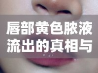 唇部黃色膿液流出的真相與應(yīng)對策略
