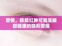 警惕，眼睛紅腫可能是眼部健康的隱形警報
