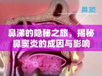 鼻涕的隱秘之旅，揭秘鼻竇炎的成因與影響