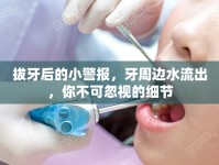 拔牙后的小警報，牙周邊水流出，你不可忽視的細節(jié)