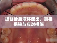 拔智齒后液體流出，真相揭秘與應(yīng)對(duì)措施