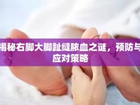 揭秘右腳大腳趾縫膿血之謎，預(yù)防與應(yīng)對(duì)策略