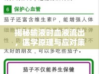 揭秘輸液時(shí)血液流出，醫(yī)學(xué)原理與應(yīng)對(duì)策略