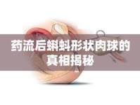 藥流后蝌蚪形狀肉球的真相揭秘