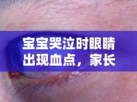 寶寶哭泣時(shí)眼睛出現(xiàn)血點(diǎn)，家長(zhǎng)需警惕的緊急信號(hào)與應(yīng)對(duì)措施