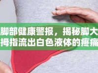 腳部健康警報，揭秘腳大拇指流出白色液體的疼痛真相
