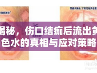 揭秘，傷口結(jié)痂后流出黃色水的真相與應對策略