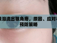 眼淚流出眼角疼，原因、應對與預防策略