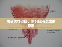 揭秘男性健康，前列腺液流出的原因