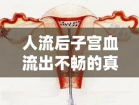 人流后子宮血流出不暢的真相與有效應對策略