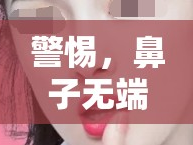警惕，鼻子無(wú)端出血或?yàn)樯眢w小信號(hào)