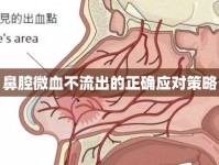 鼻腔微血不流出的正確應(yīng)對策略
