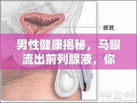 男性健康揭秘，馬眼流出前列腺液，你真的了解嗎？