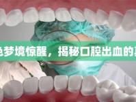 血色夢境驚醒，揭秘口腔出血的真相