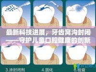 最新科技進(jìn)展，牙齒窩溝封閉——守護(hù)兒童口腔健康的創(chuàng)新之選