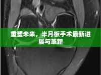 重塑未來，半月板手術最新進展與革新