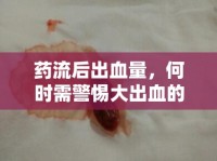 藥流后出血量，何時(shí)需警惕大出血的信號(hào)？