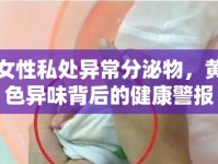 女性私處異常分泌物，黃色異味背后的健康警報(bào)