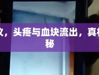 建議，頭疼與血塊流出，真相揭秘