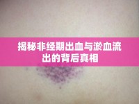 揭秘非經(jīng)期出血與淤血流出的背后真相