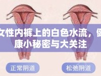 女性?xún)?nèi)褲上的白色水流，健康小秘密與大關(guān)注