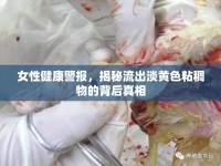 女性健康警報(bào)，揭秘流出淡黃色粘稠物的背后真相