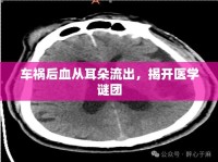 車禍后血從耳朵流出，揭開醫(yī)學(xué)謎團(tuán)