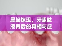晨起驚現(xiàn)，牙齦膿液背后的真相與應(yīng)對策略