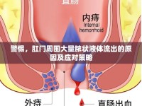 警惕，肛門周圍大量膿狀液體流出的原因及應對策略