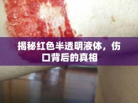 揭秘紅色半透明液體，傷口背后的真相