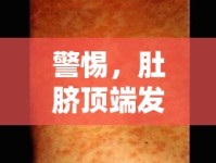 警惕，肚臍頂端發(fā)紅或?yàn)楦腥拘盘?，粘液流出背后的真? />									</div>
			</a>
			<div   id=