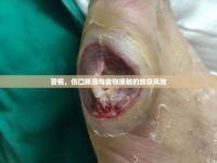 警惕，傷口膿液與食物接觸的致命風(fēng)險