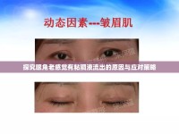 探究眼角老感覺有粘稠液流出的原因與應(yīng)對策略