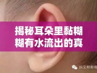 揭秘耳朵里黏糊糊有水流出的真相