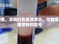 警惕，濃稠白色鼻涕帶血，可能是健康警鐘的信號