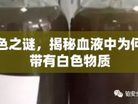 血色之謎，揭秘血液中為何會帶有白色物質