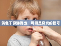 黃色干鼻涕流出，可能是鼻炎的信號(hào)