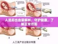 人流后出血量解析，守護健康，了解正常范圍